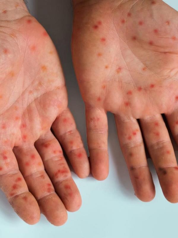 Reconstruire leurs visages