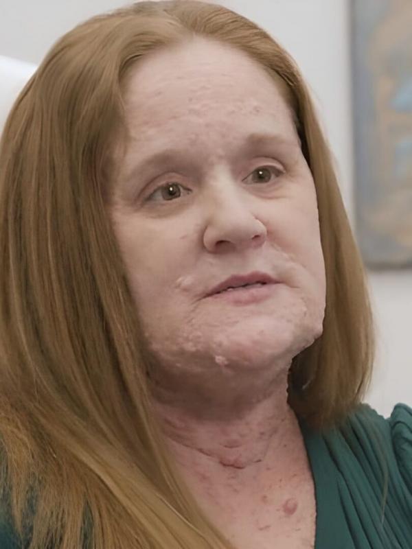 Reconstruire leurs visages