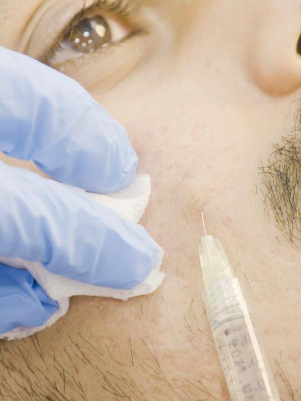SOS Dermato