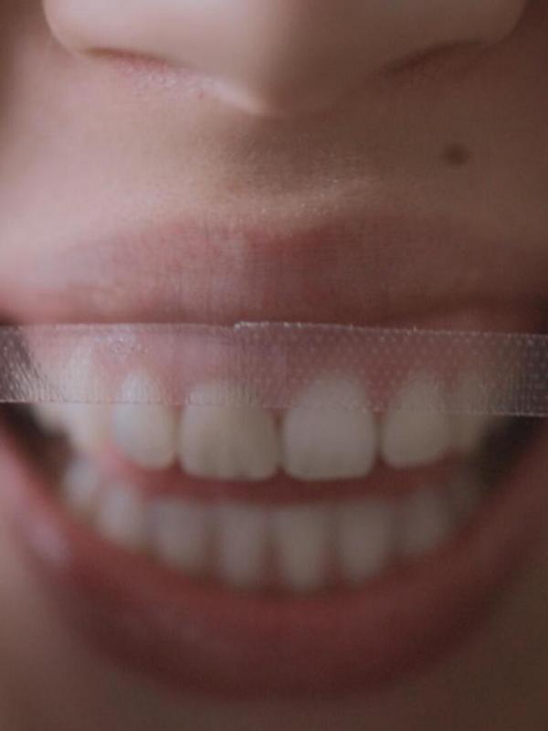 Des dents blanches... au rire jaune !